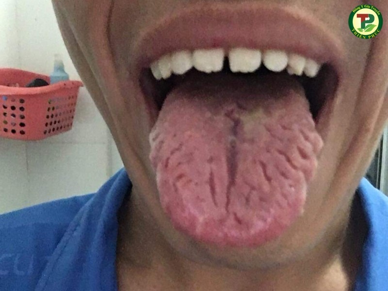 Vệ sinh công nghiệp – KH công ty thực phẩm Masan